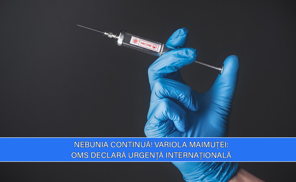 mpox Sănătate